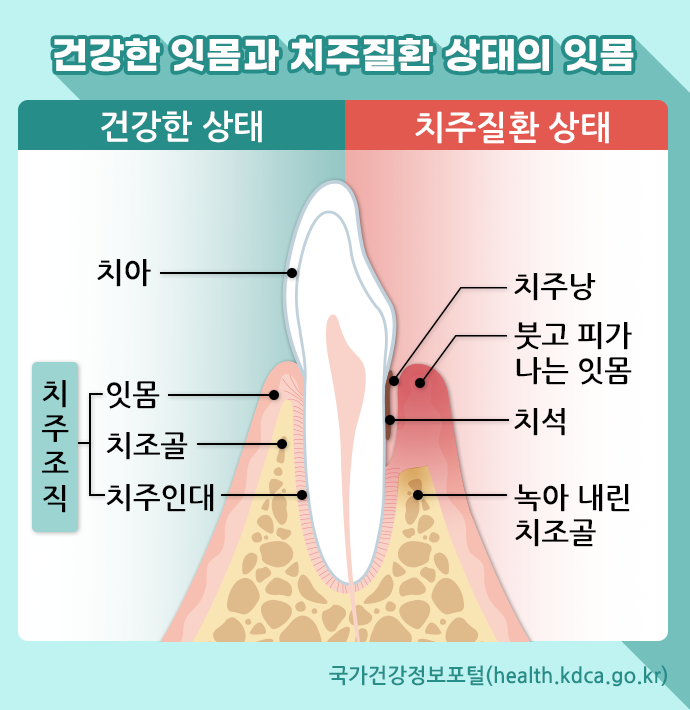 환한 미소