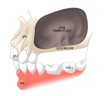 파노라마 진단 상담