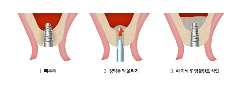 전문의 상담