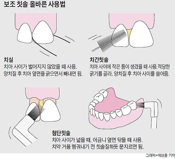 구강 관리