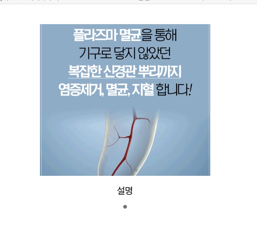신경치료 대표 이미지